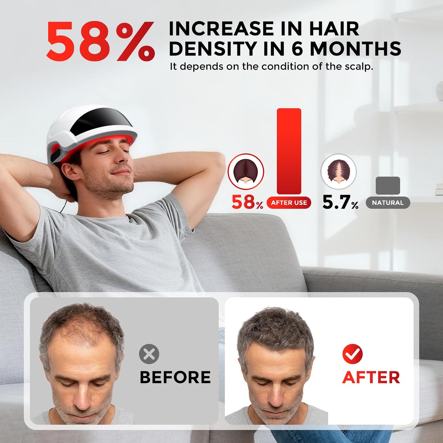 Person using Ovekpa red light hair regrowth device at home