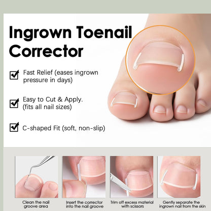 The complete 7 piece premium foot care packaging displaying all included alignment accessories.
