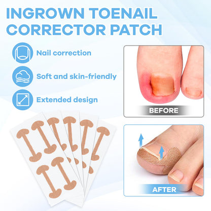 Double ended stainless steel nail lifter and file tools included in the professional pedicure kit.