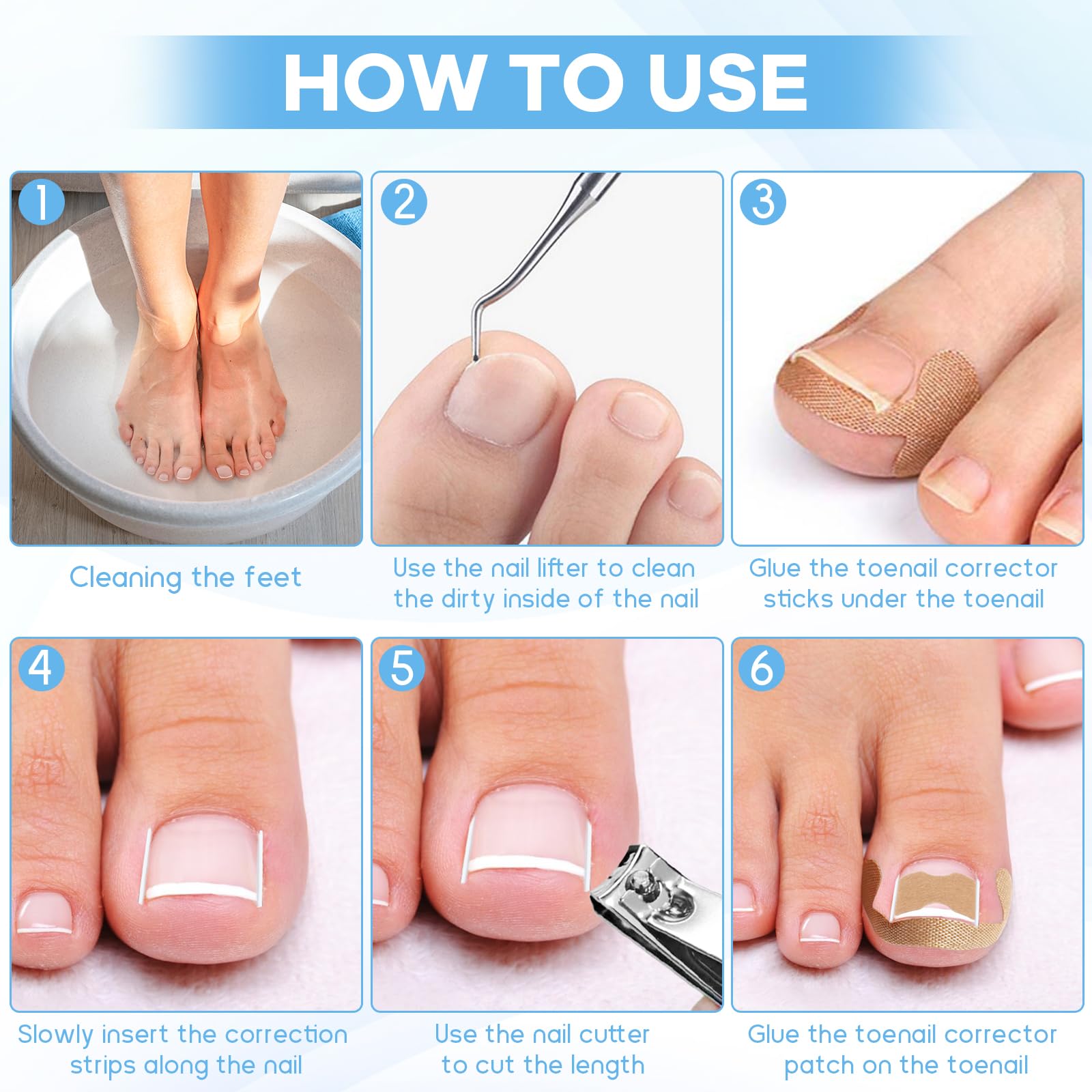 Complete sixty piece set of flexible nail correction strips and adhesive patches displayed on a flat surface.