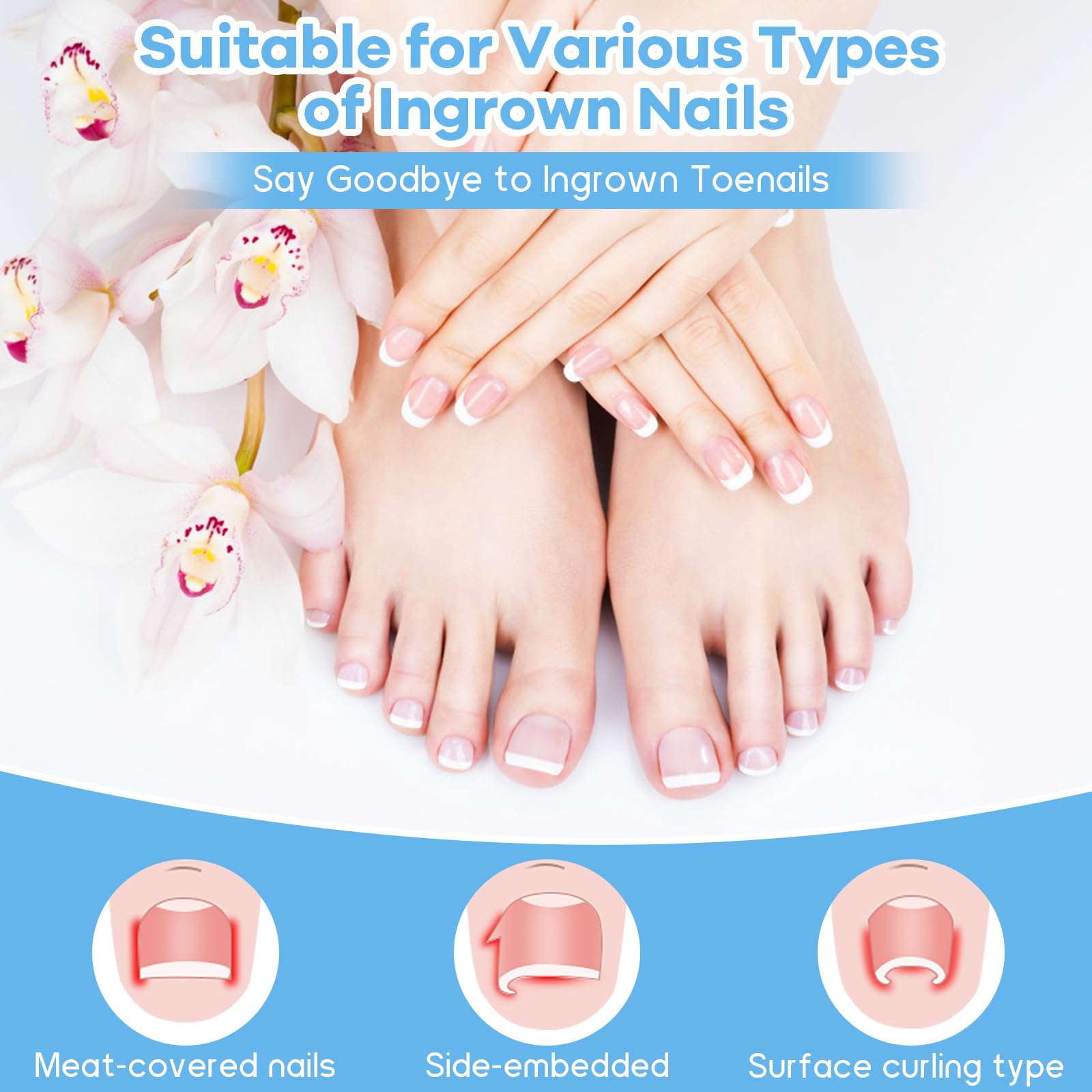 Detailed illustration showing the lever mechanics of the patch straightening a curved toenail to reduce skin pressure.