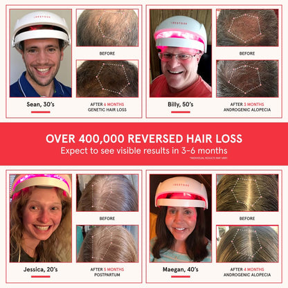 iRestore laser hair growth helmet on model