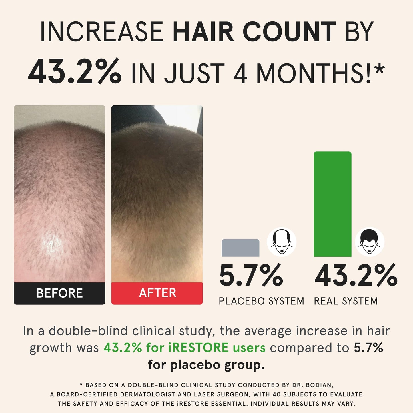 iRestore hair growth system inner laser configuration