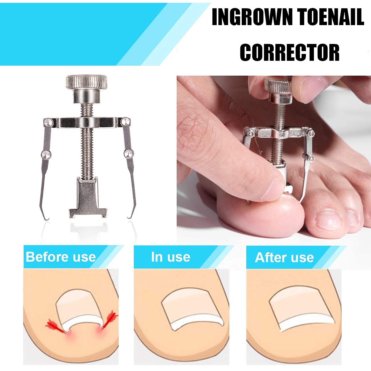 Dualeco surgery-grade toenail clipper blade detail