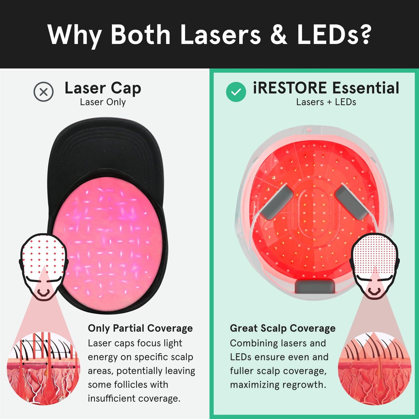 Packaging of iRestore Essential Hair Growth System