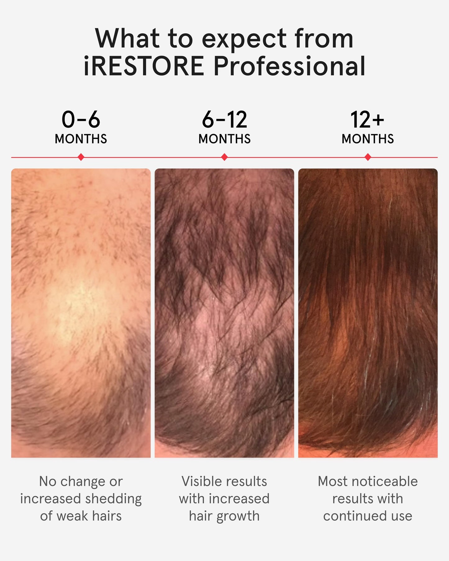 User wearing Irestore Professional laser hair growth helmet