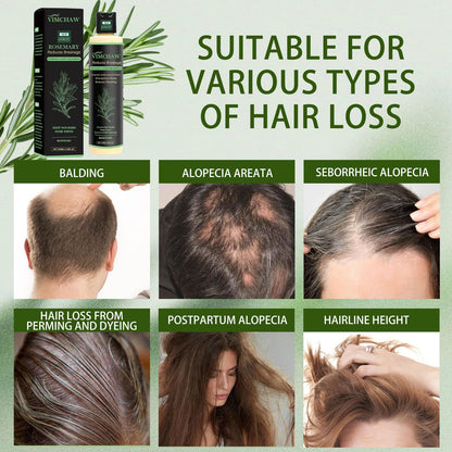 Close up of 100 milliliters packaging for imported rosemary scalp detox shampoo.
