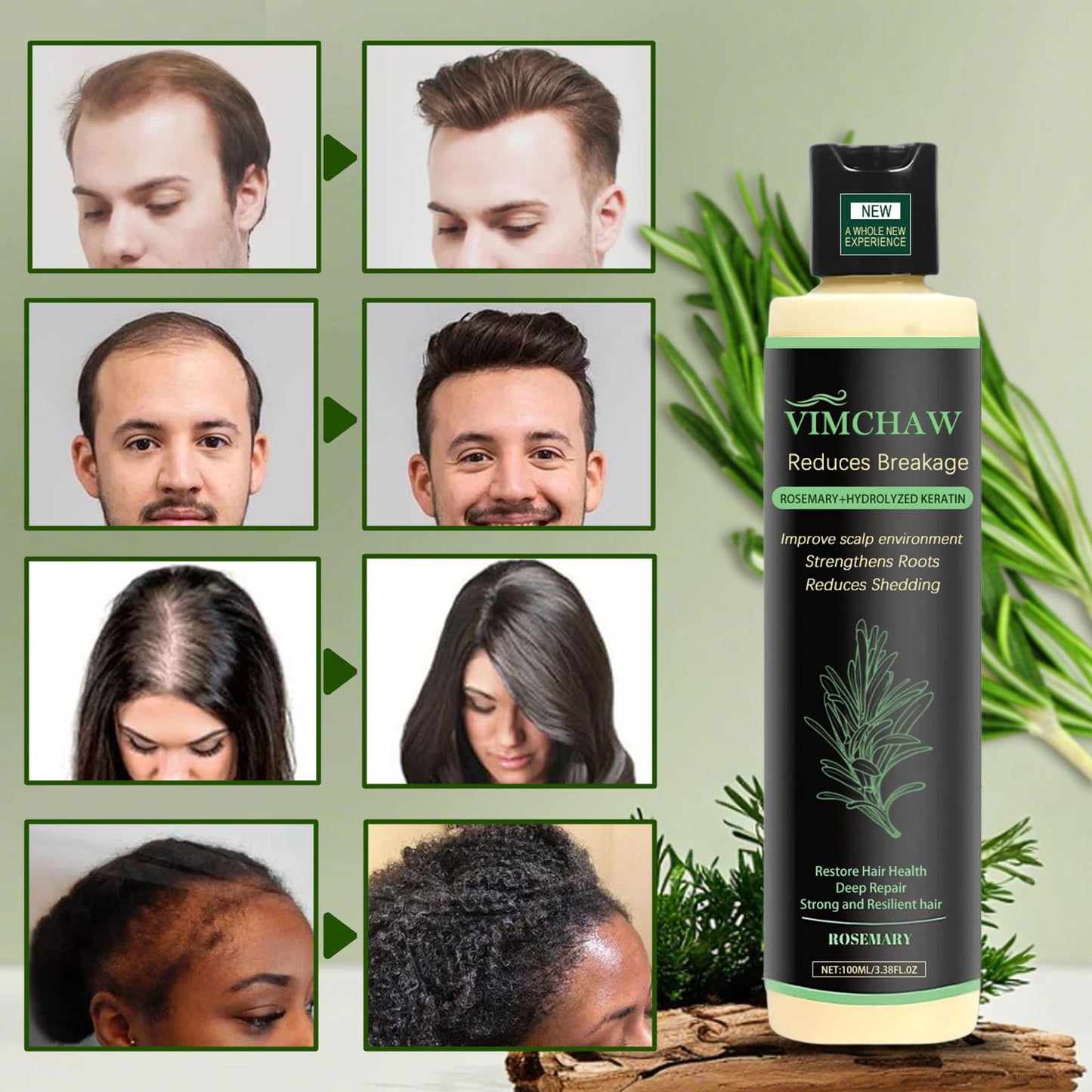 MEETIPLY rosemary shampoo three pack highlighting root strengthening benefits.