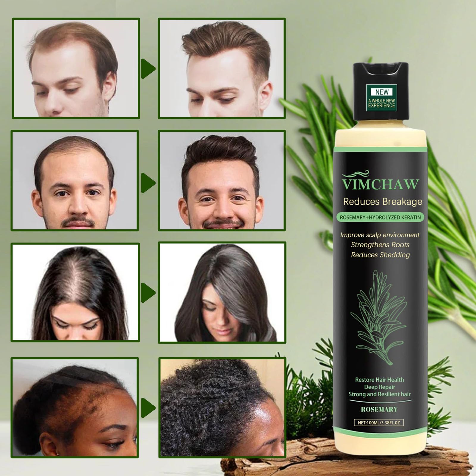 MEETIPLY rosemary shampoo three pack highlighting root strengthening benefits.