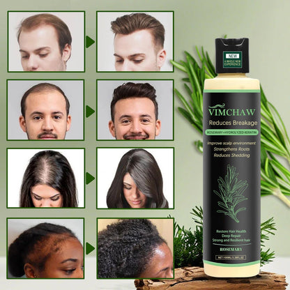 MEETIPLY rosemary shampoo three pack highlighting root strengthening benefits.