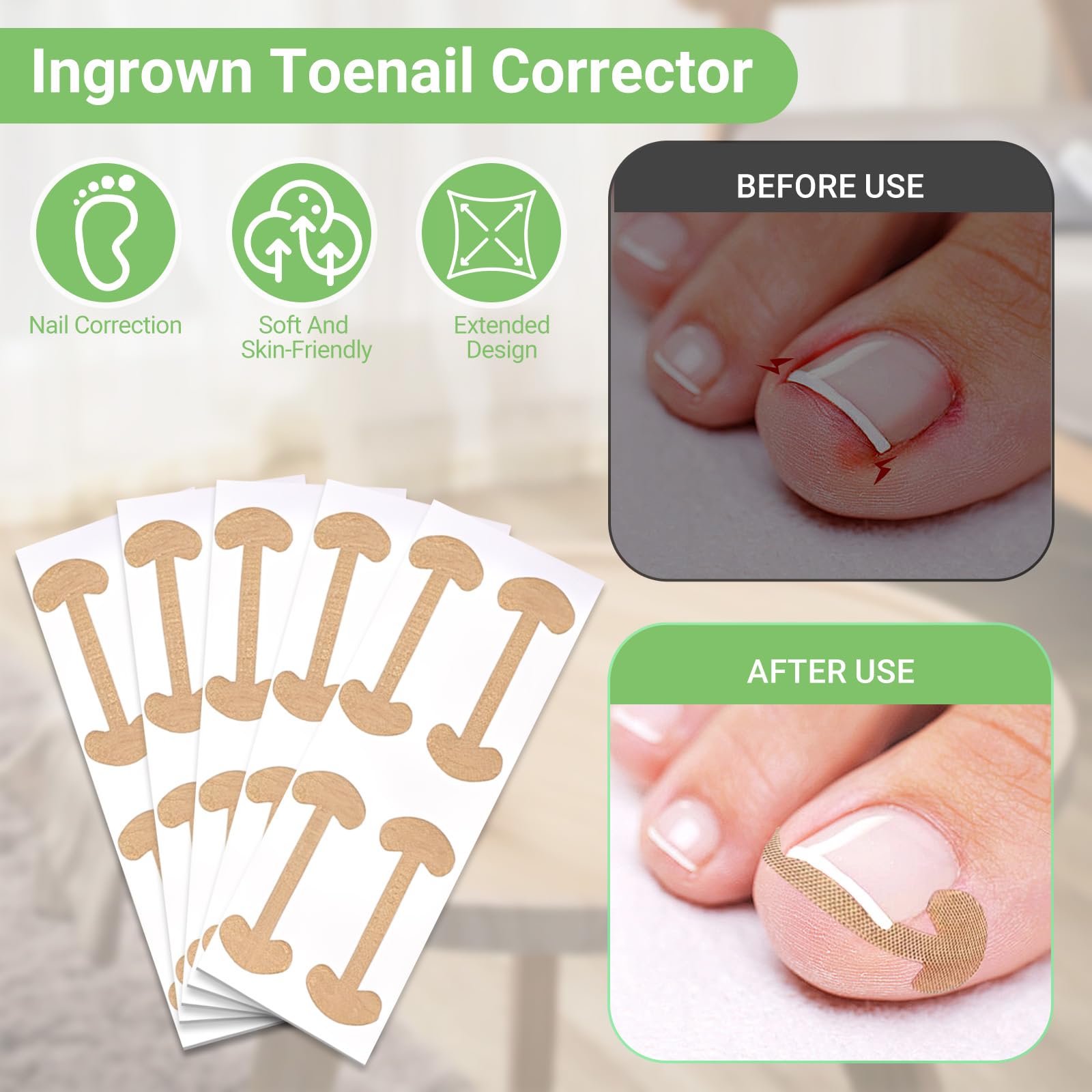 Flat-head stainless steel nail clippers designed for straight-across cutting to prevent ingrown toenails