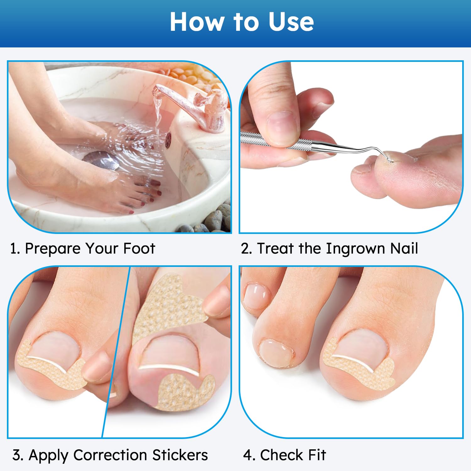 Demonstration of mechanical lifting method used by non-invasive nail correction stickers.