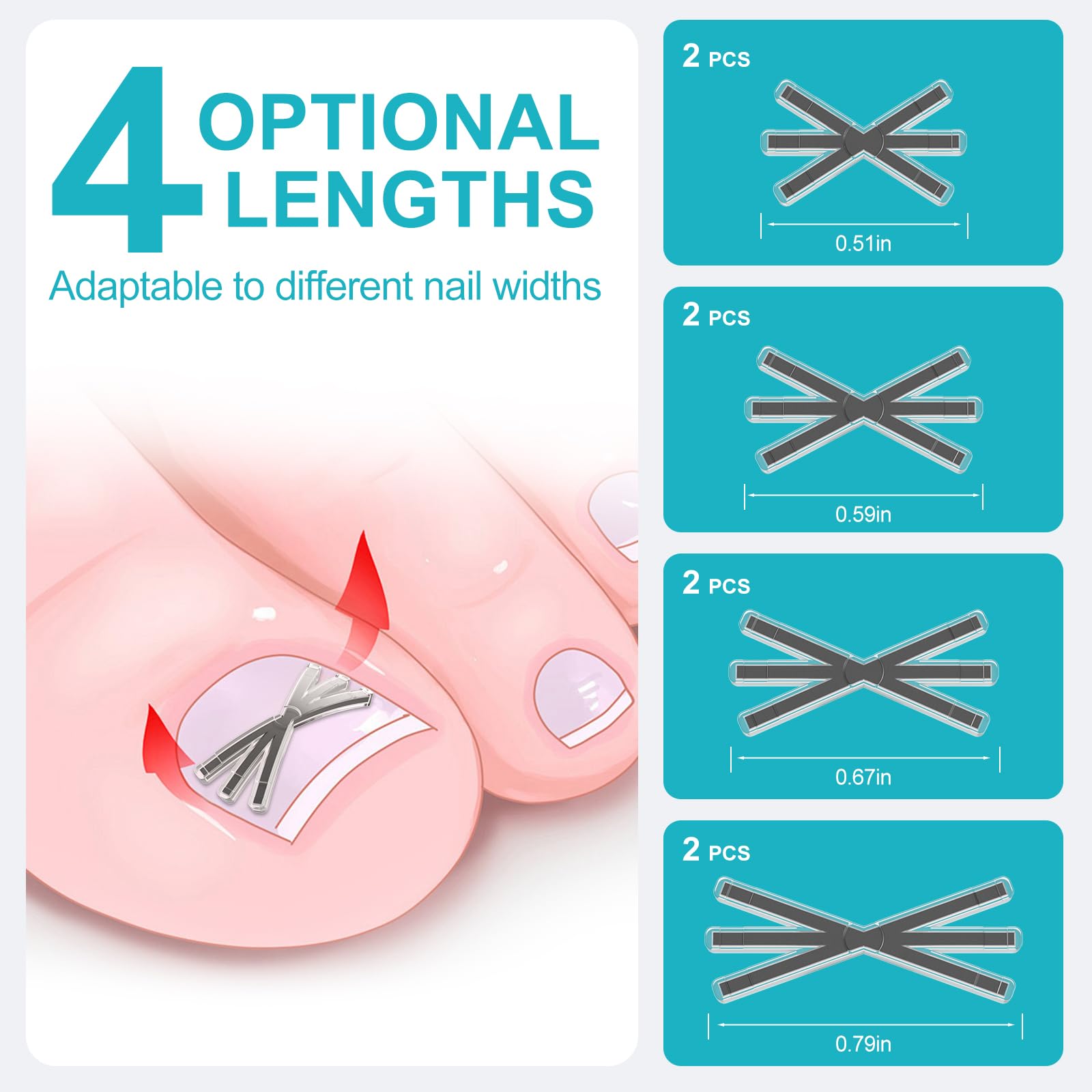 Upgraded six angle X-shape titanium alloy nail corrector strip close up view showcasing flexible memory metal