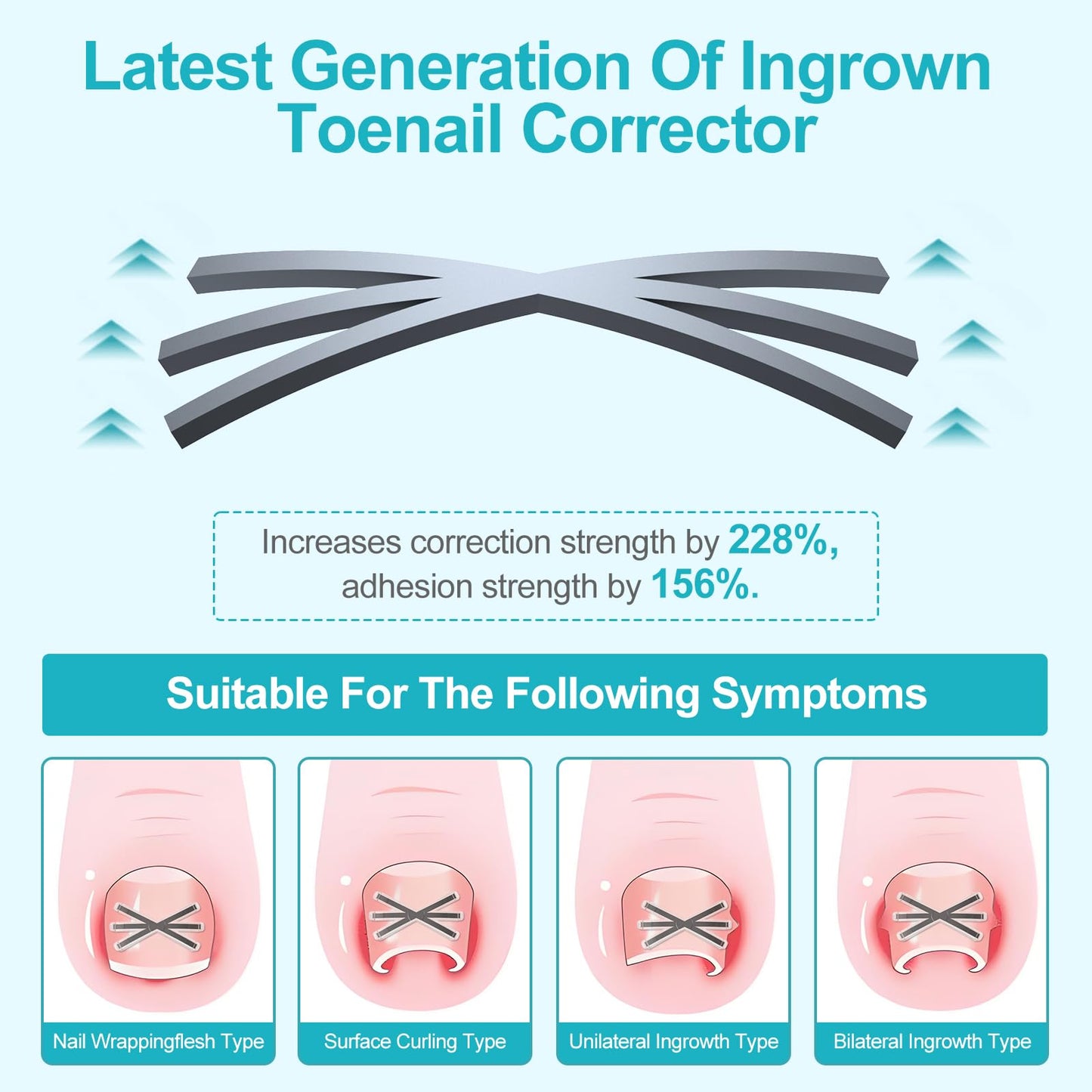 Four multi-sizes of ingrown toenail correction patches arranged neatly to demonstrate varying widths
