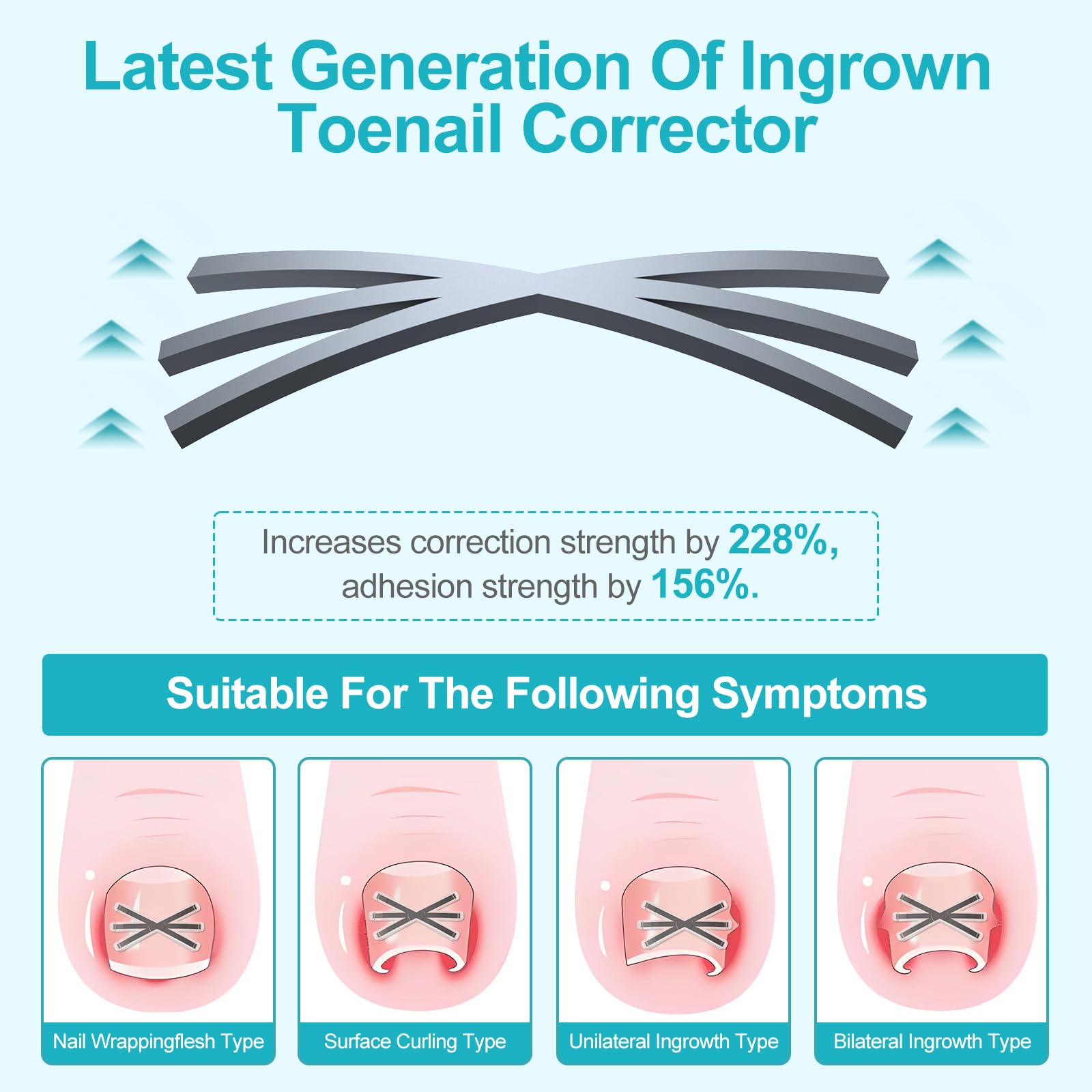 Four multi-sizes of ingrown toenail correction patches arranged neatly to demonstrate varying widths
