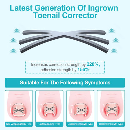 Four multi-sizes of ingrown toenail correction patches arranged neatly to demonstrate varying widths