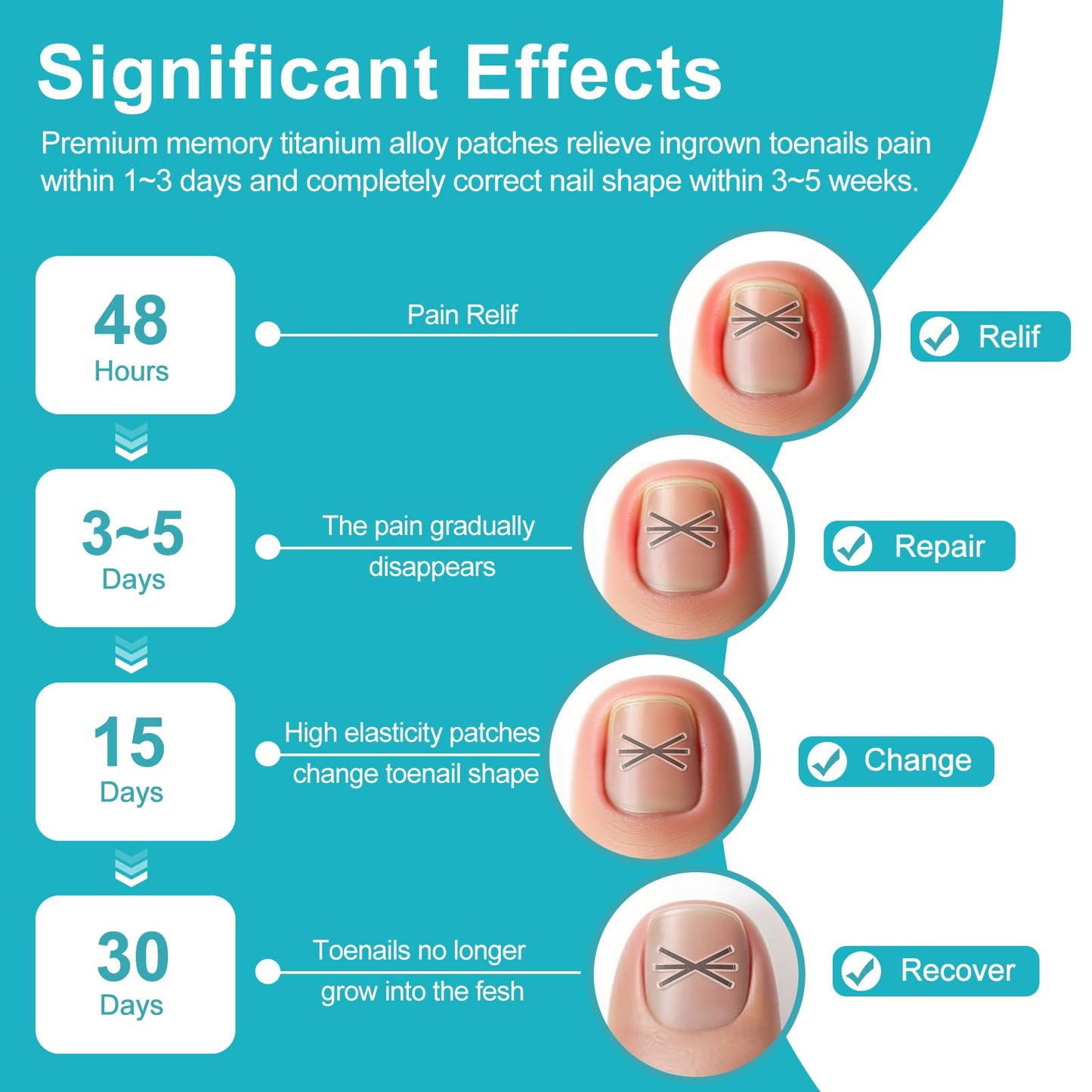 Step by step application of the memory alloy strip on a curved toenail for pain relief