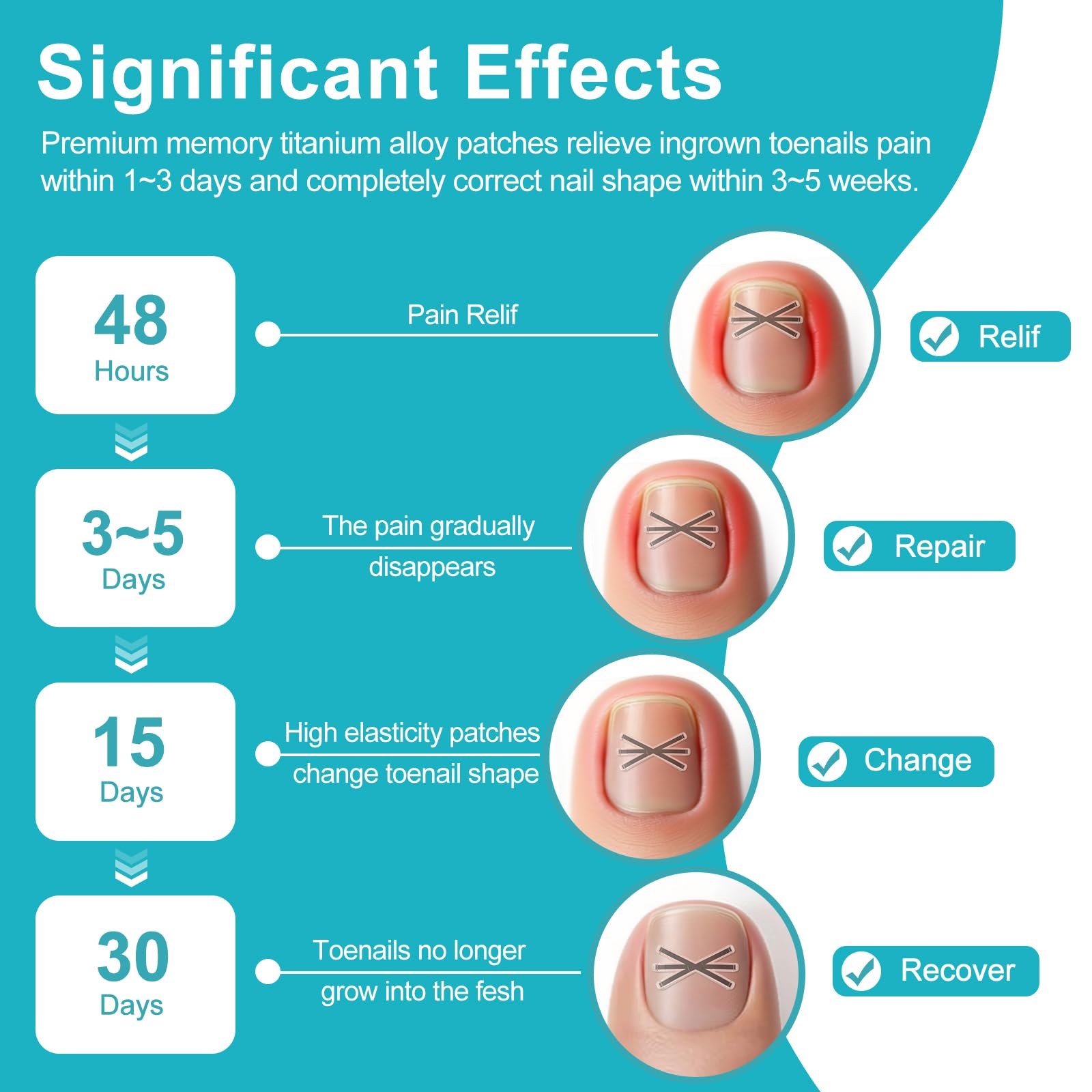 Step by step application of the memory alloy strip on a curved toenail for pain relief