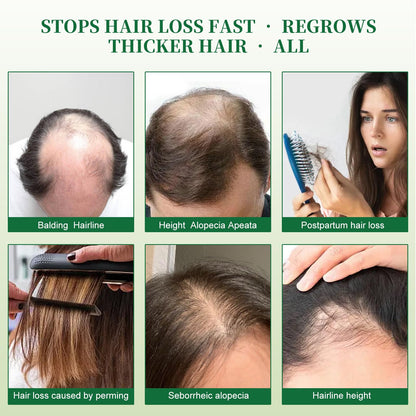 Imported American hair thickening shampoo enriched with vitamin E and keratin