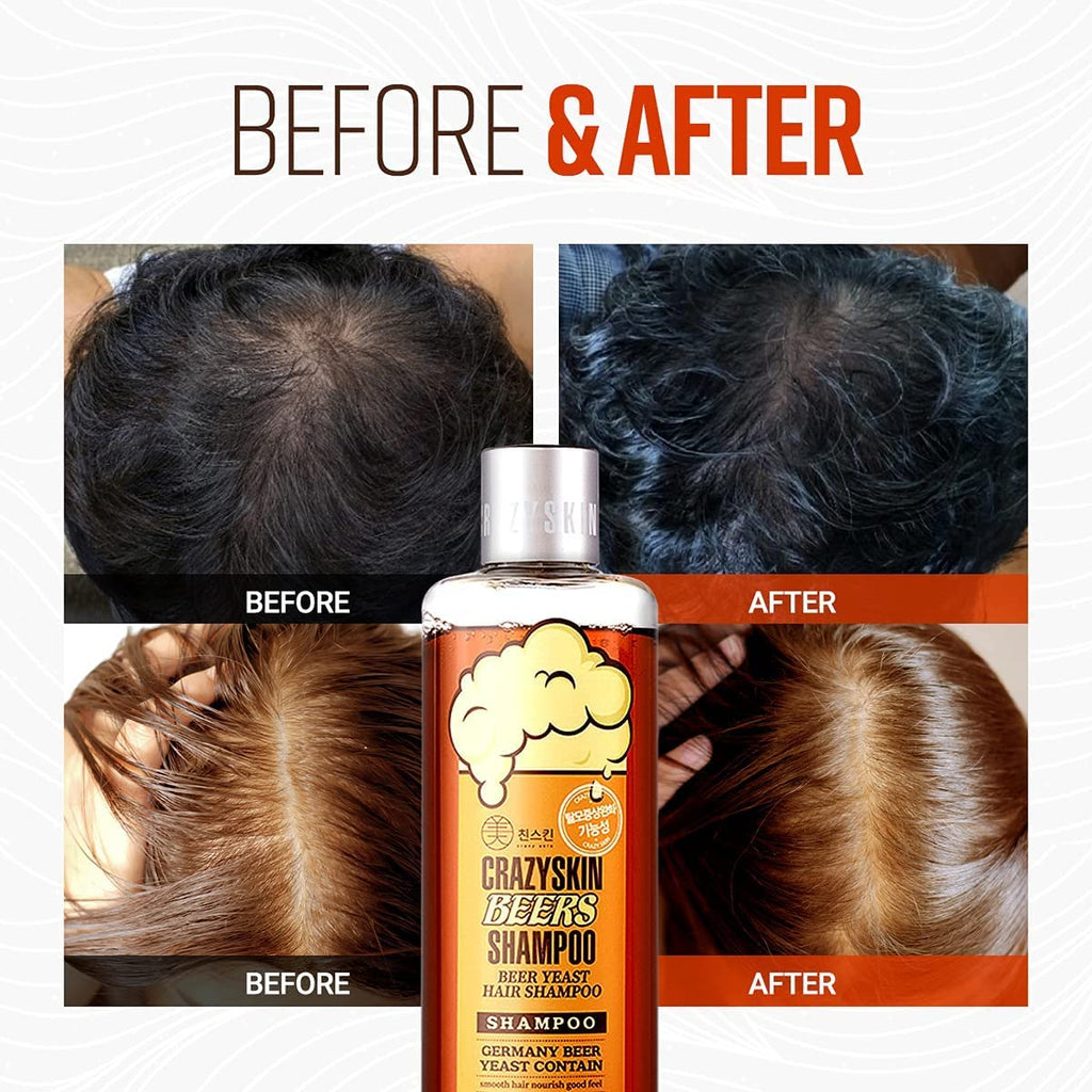 Crazy Skin Biotin Shampoo two pack bottles layout