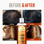 Crazy Skin Biotin Shampoo two pack bottles layout