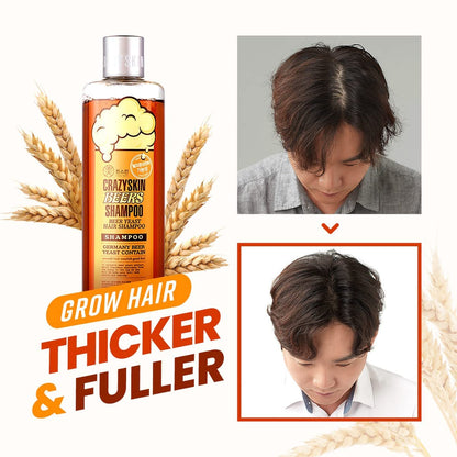 CRAZY SKIN biotin shampoo for hair regrowth and thickening close up bottle details
