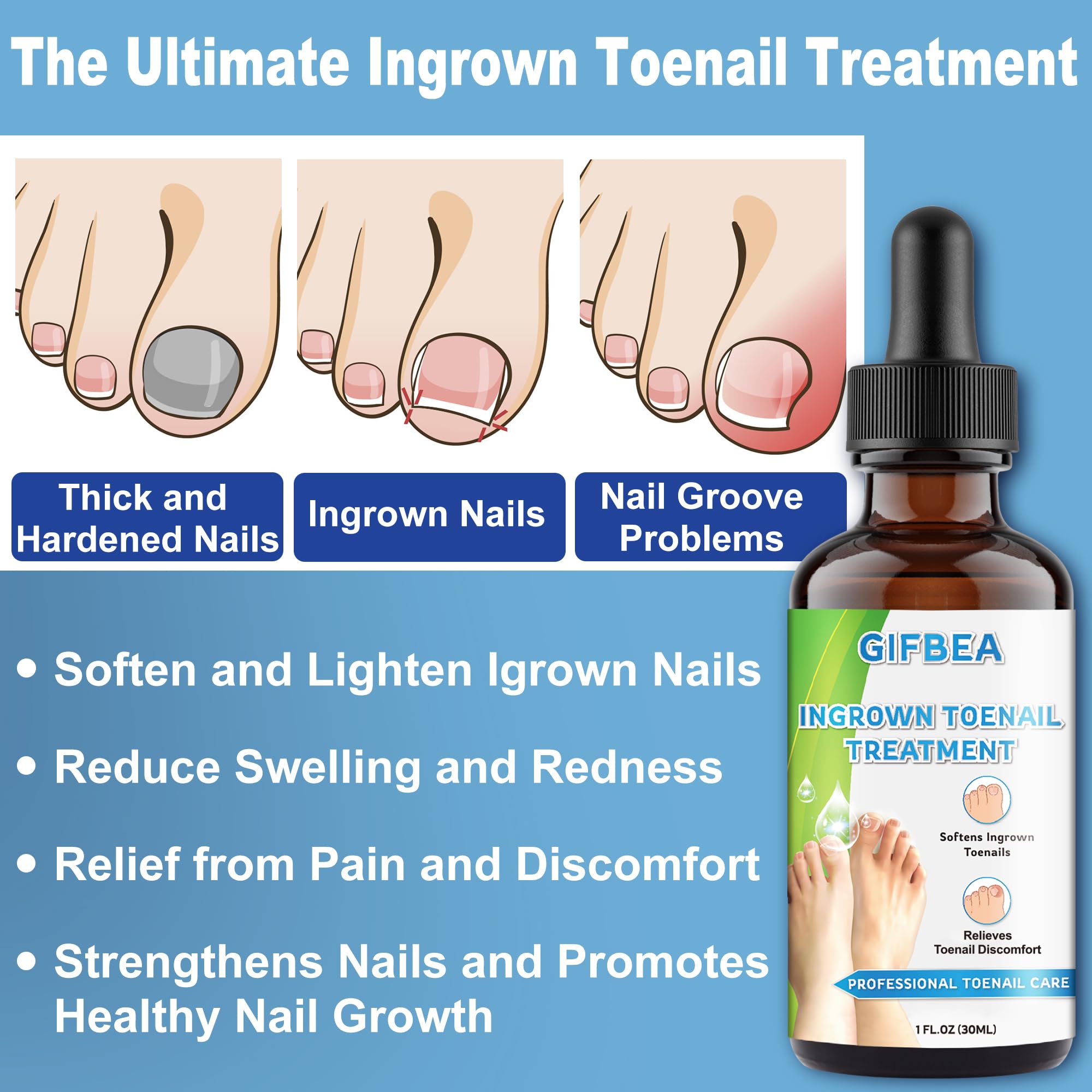 Silicone toe caps included in Gifbea nail treatment set
