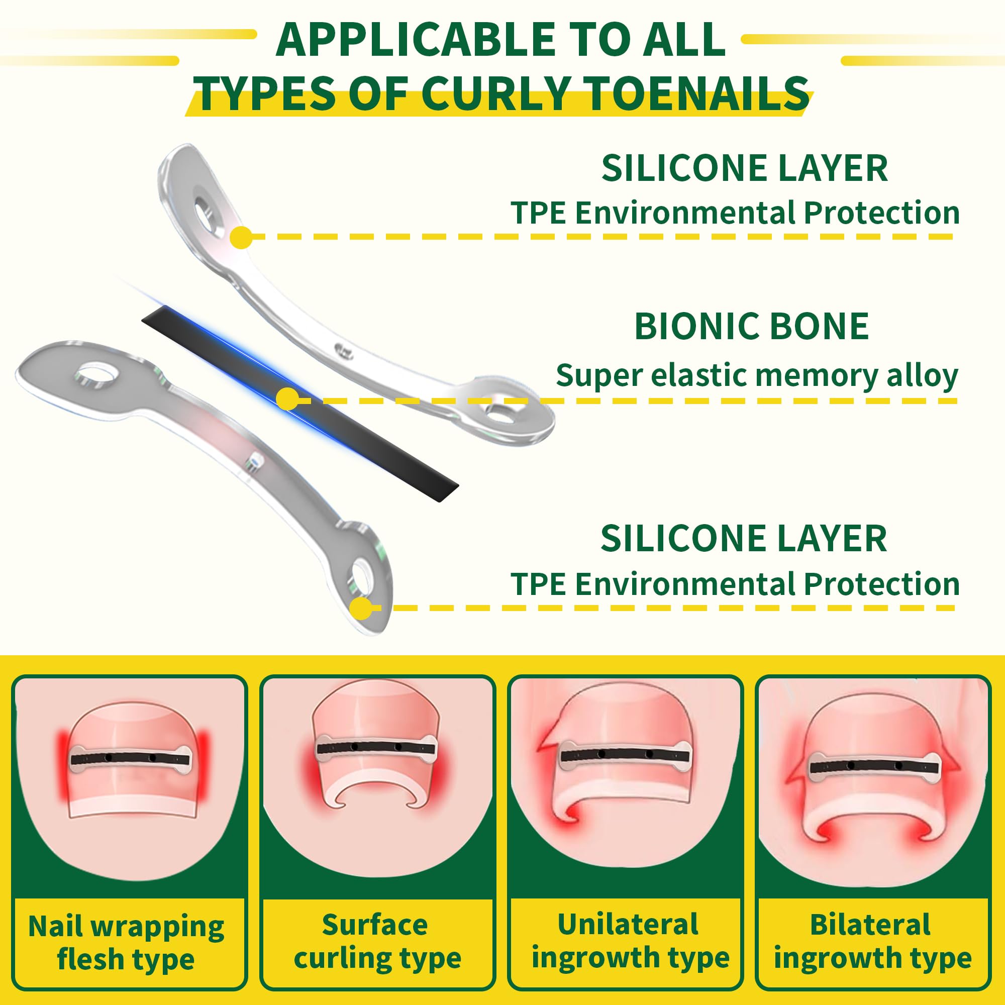 Fuzzycare professional ingrown nail corrector tools set