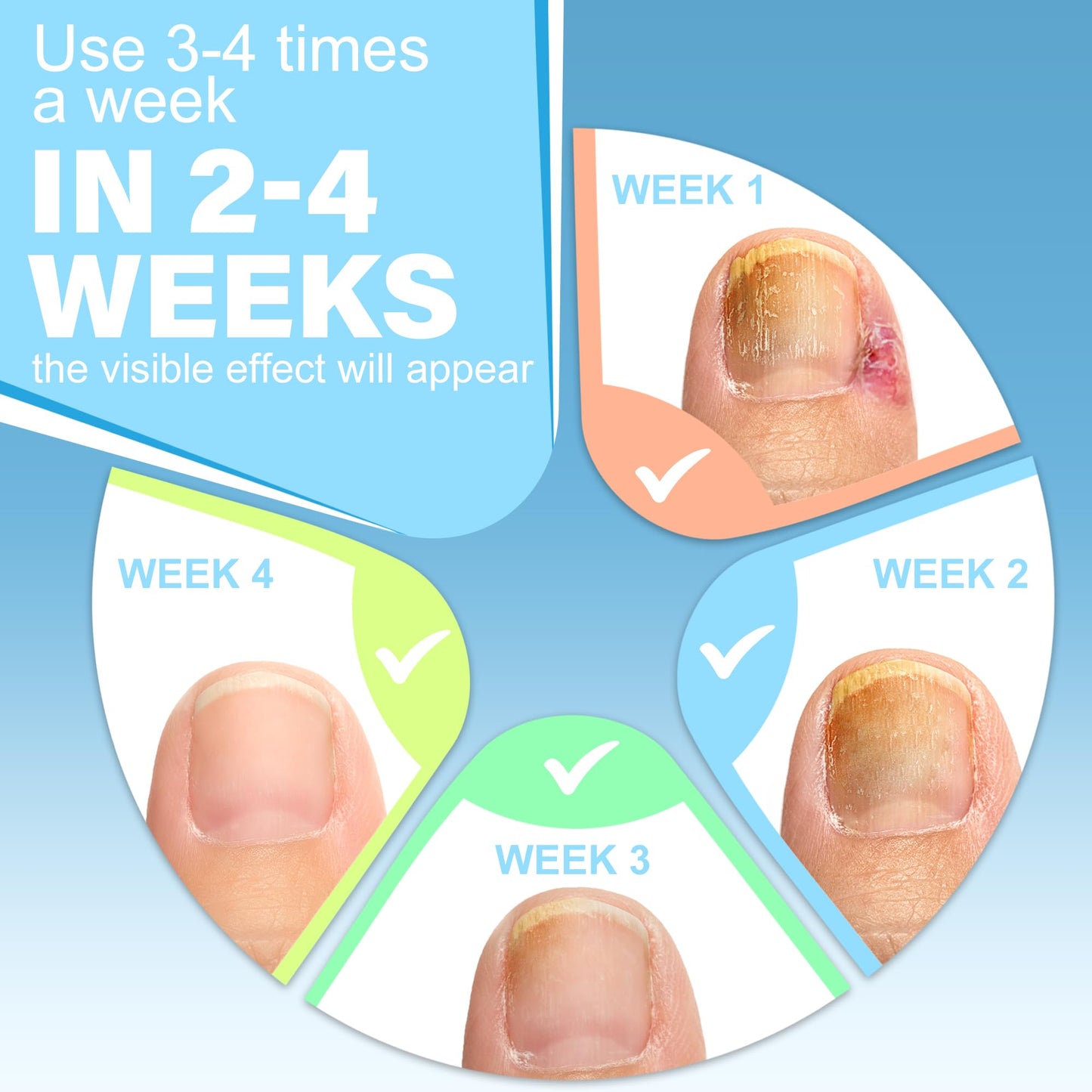 Instructions for using Gifbea ingrown toenail relief kit