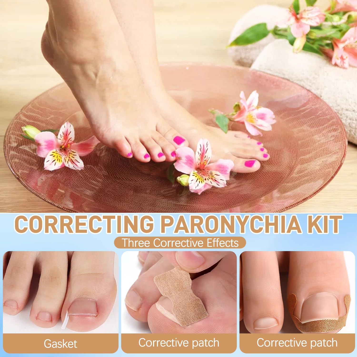 Breathable ingrown toenail strips used for securing correction braces at home.