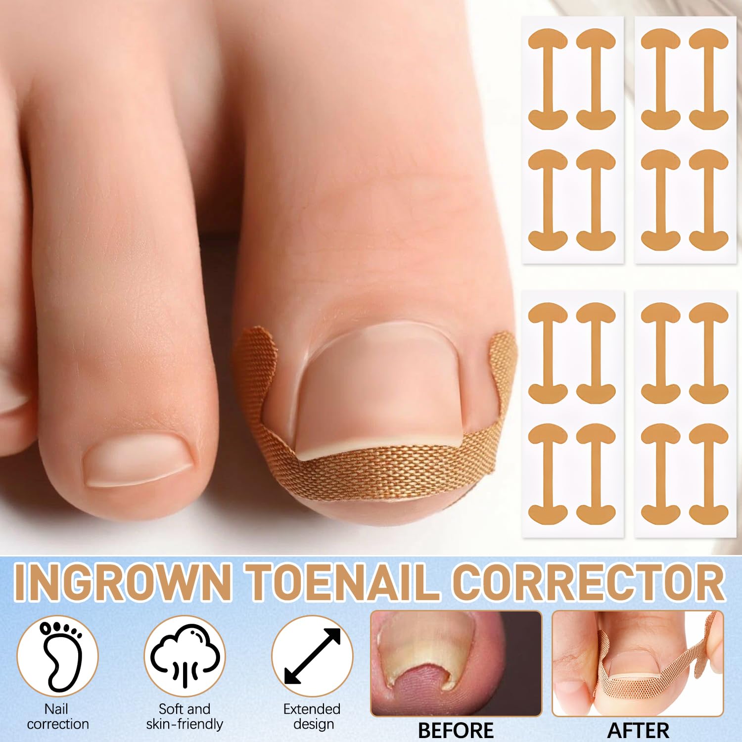 Close up view of the adhesive correction patches being applied to a curved toenail.