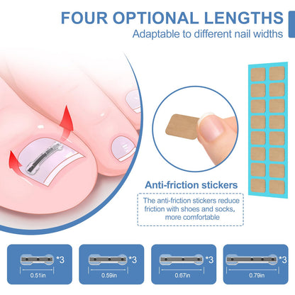 Titanium alloy toenail correction patches in four multi sizes displayed on a flat surface