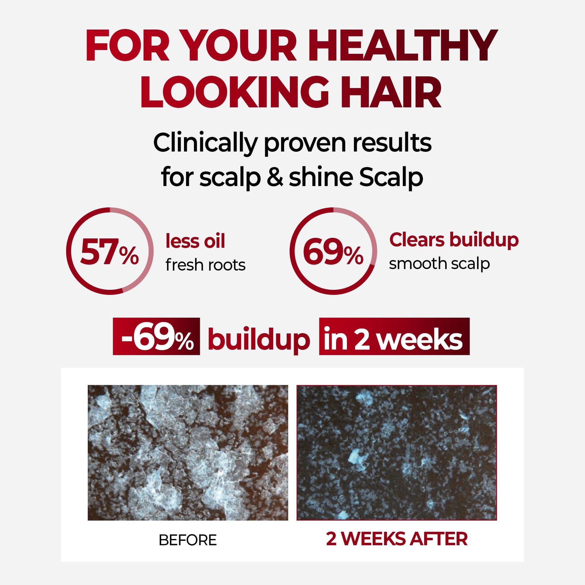 Kundal anti hair loss shampoo bottle showing caffeine ingredients