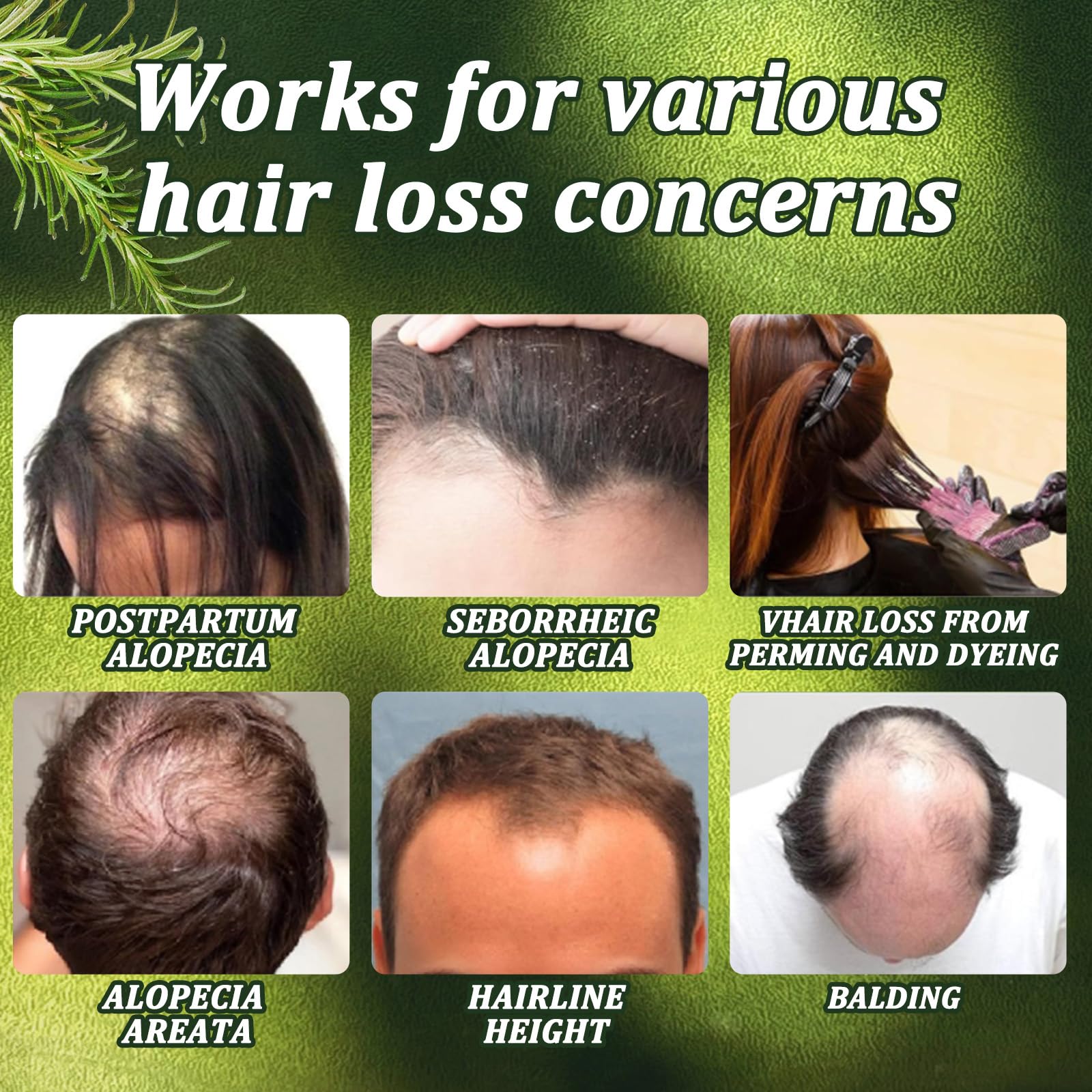 AMOADO hair strengthening formula lifestyle shot illustrating daily scalp care application