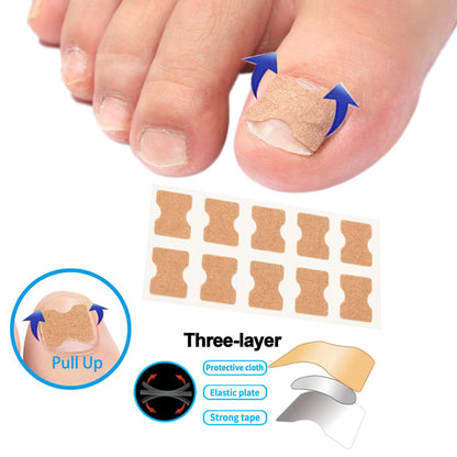 Medical grade elastic toenail patches and adhesive strips for curved nail treatment