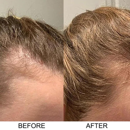 Excalvo hair growth formulation lifestyle image showing product texture.