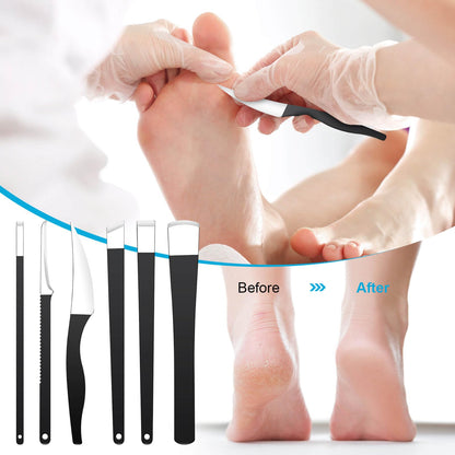 Professional callus shaver and ingrown toenail removal kit displayed on a clean surface
