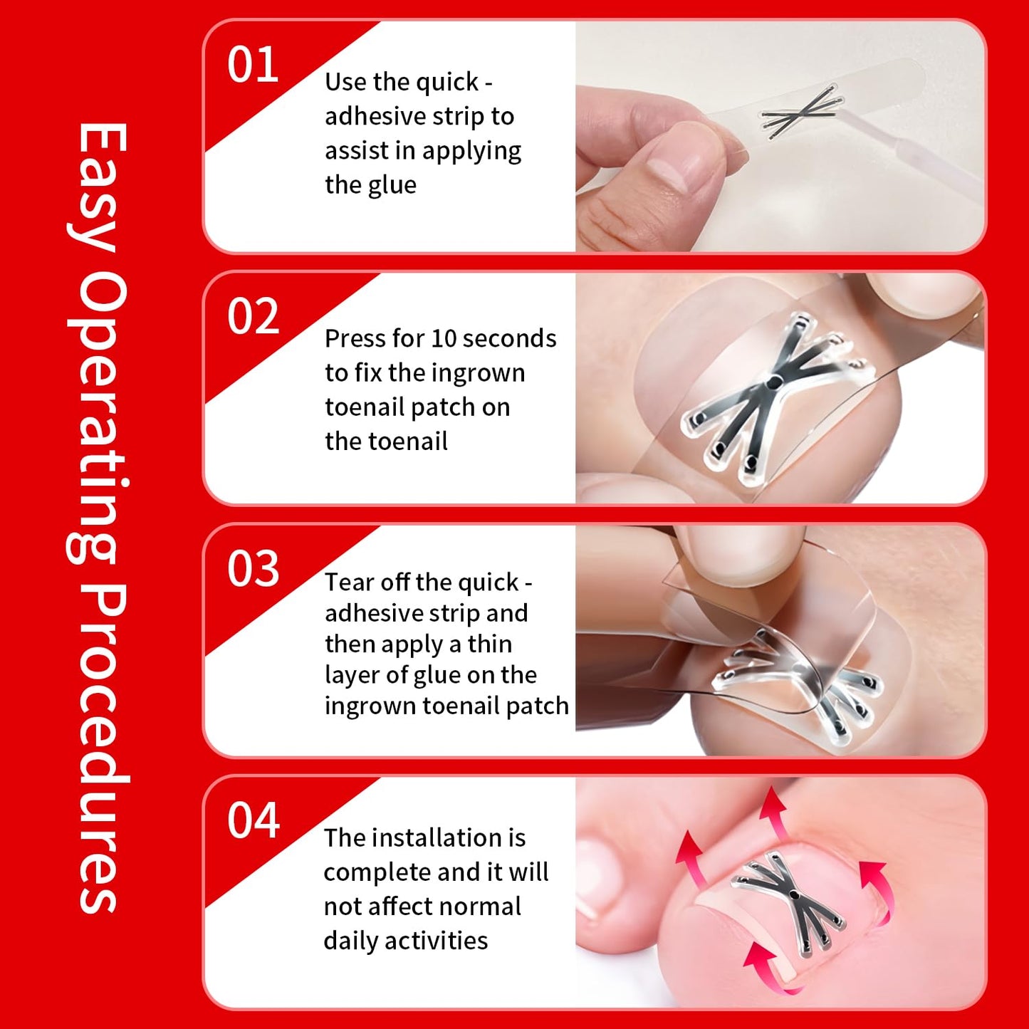 Side profile of a premium titanium nail corrector strip demonstrating the flexible metal curve before application.