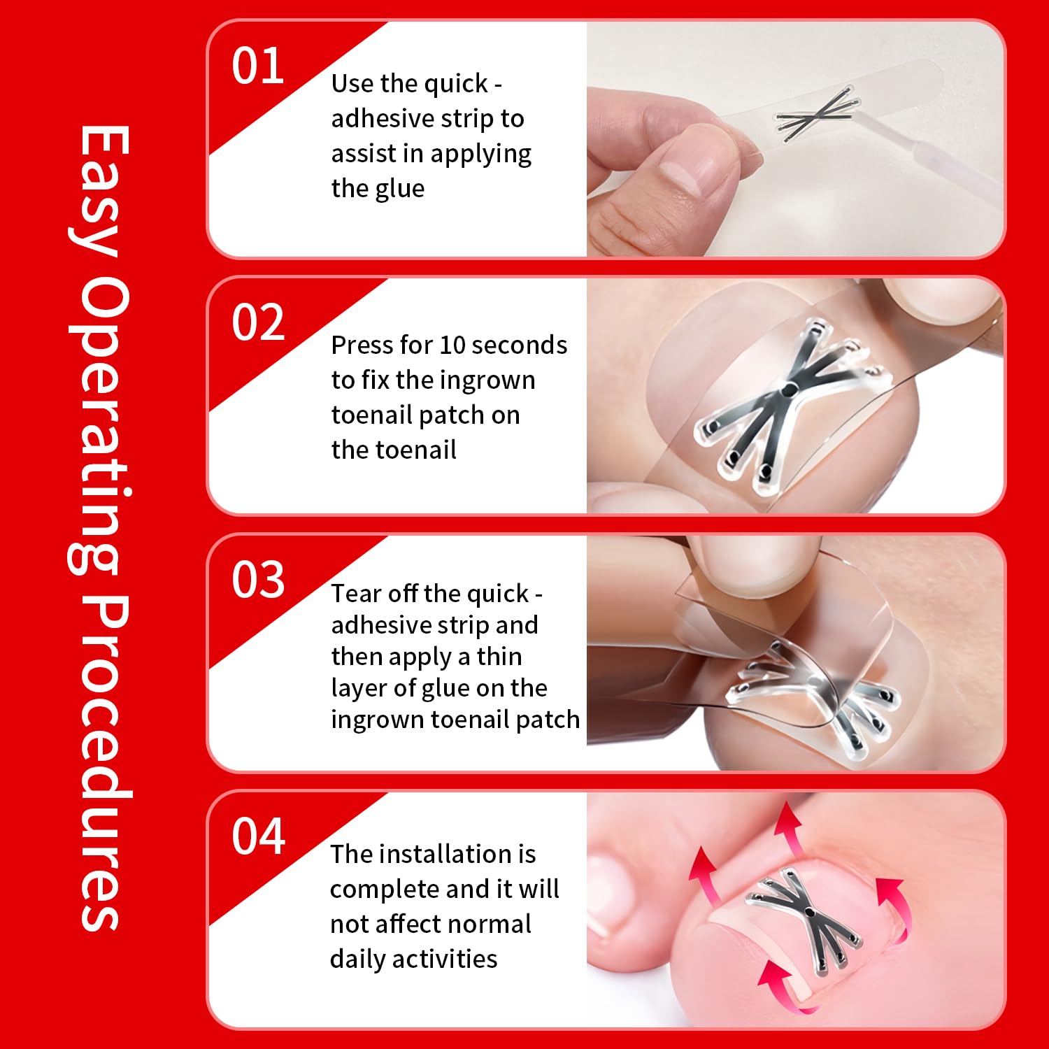 Side profile of a premium titanium nail corrector strip demonstrating the flexible metal curve before application.