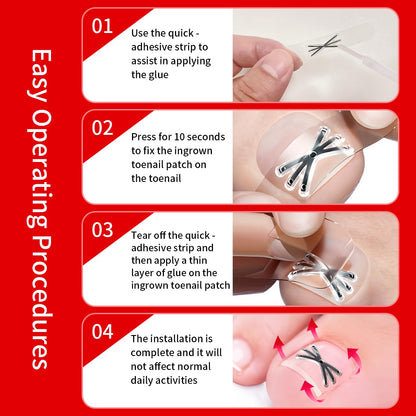 Side profile of a premium titanium nail corrector strip demonstrating the flexible metal curve before application.