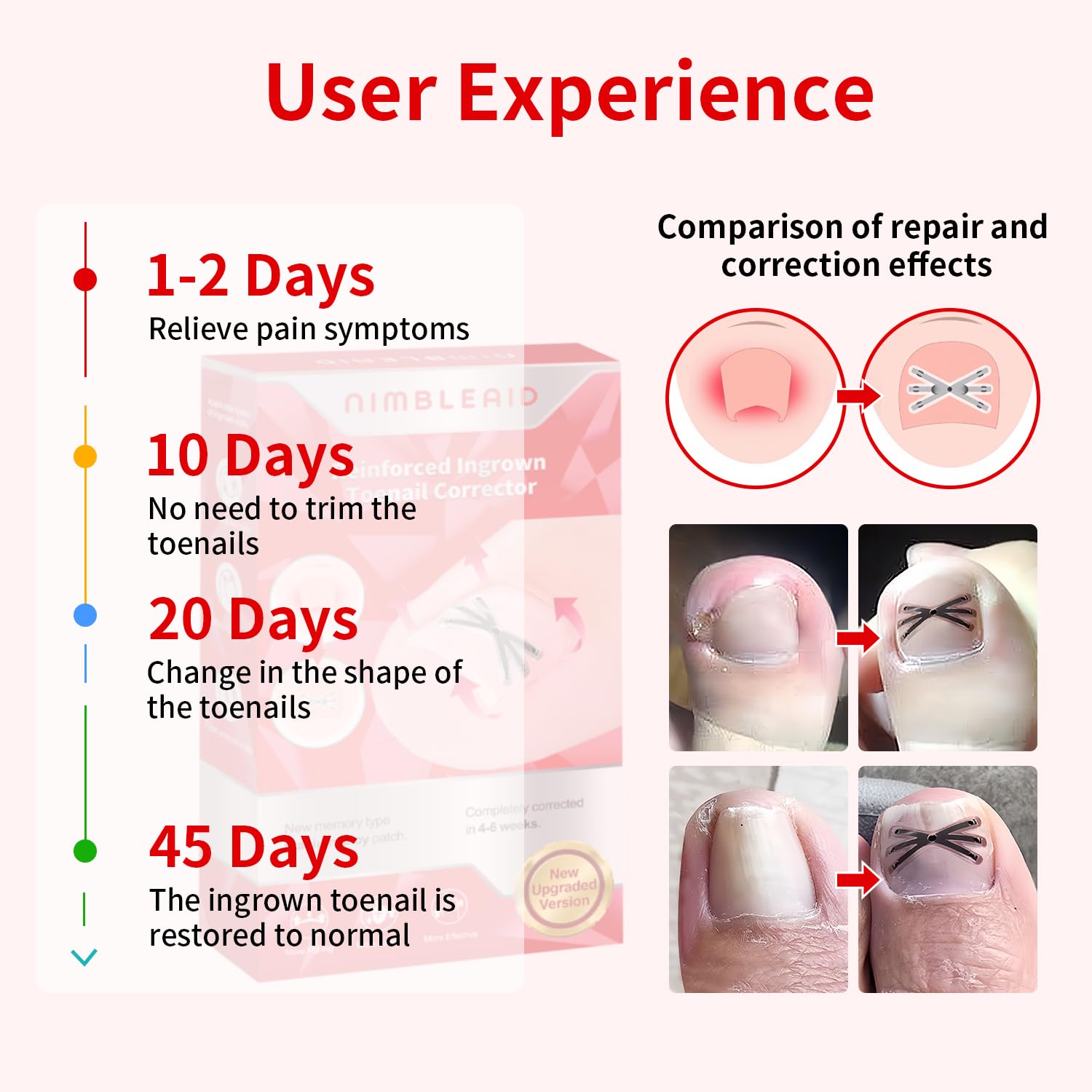 Vitasy six angle toenail straightening patch applied to a nail to illustrate the lifting mechanism and force distribution.