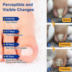 Tools for at home toenail straightening included in Yanxifei kit