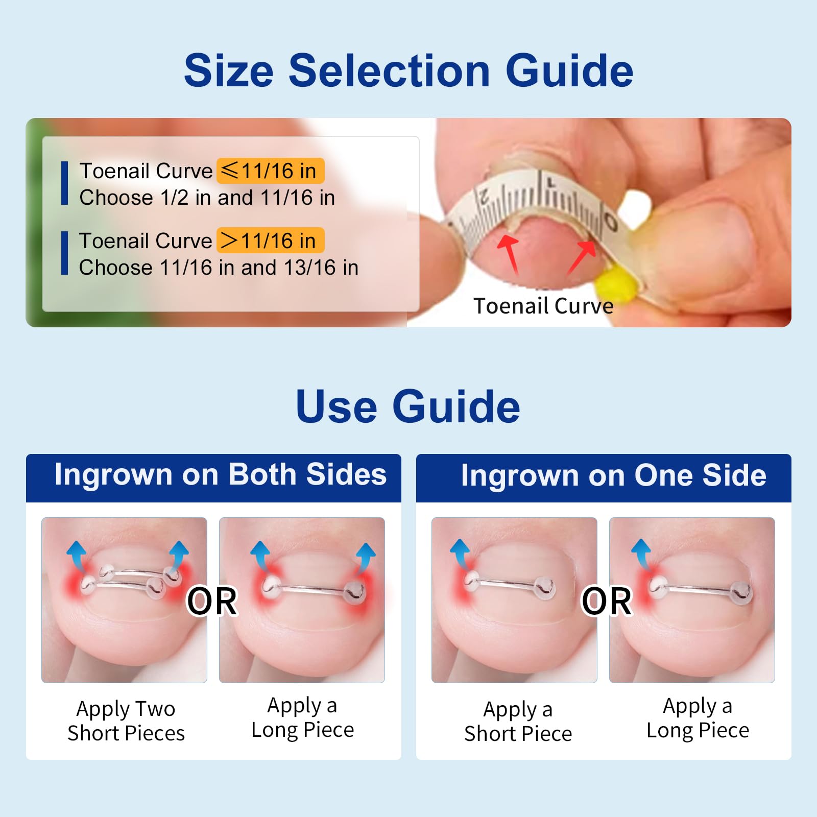 Full contents of Yanxifei ingrown toenail relief kit