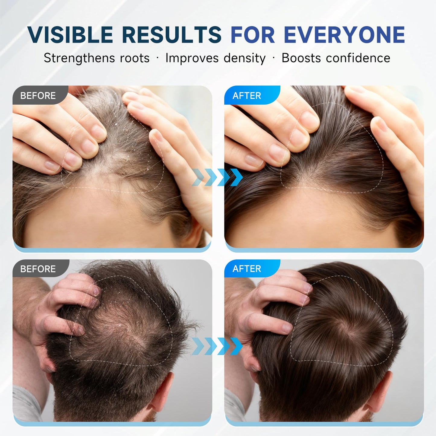 Ovexlio thickening shampoo displaying the natural ingredients like argan oil and tea tree oil.
