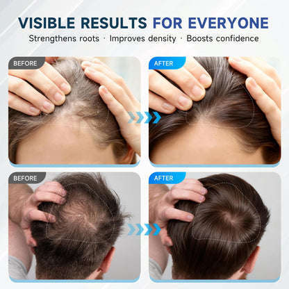 Ovexlio thickening shampoo displaying the natural ingredients like argan oil and tea tree oil.