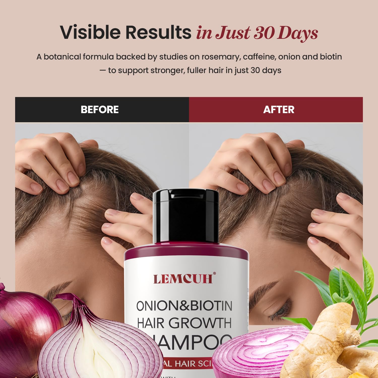 USA imported Lemcuh hair regrowth shampoo featuring tea tree and ginger extracts