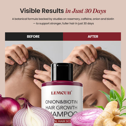 USA imported Lemcuh hair regrowth shampoo featuring tea tree and ginger extracts