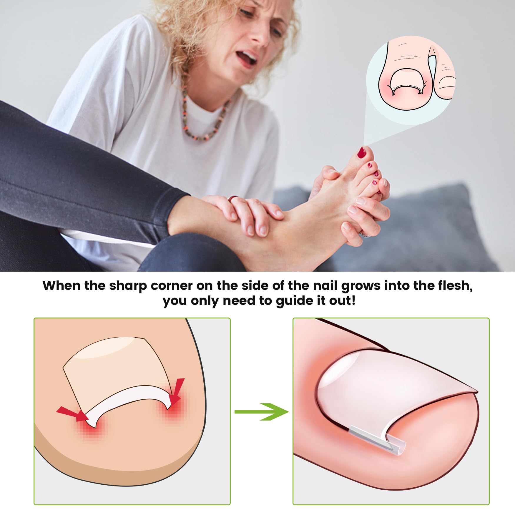 Close up of 40-piece ingrown toenail straightening strips.