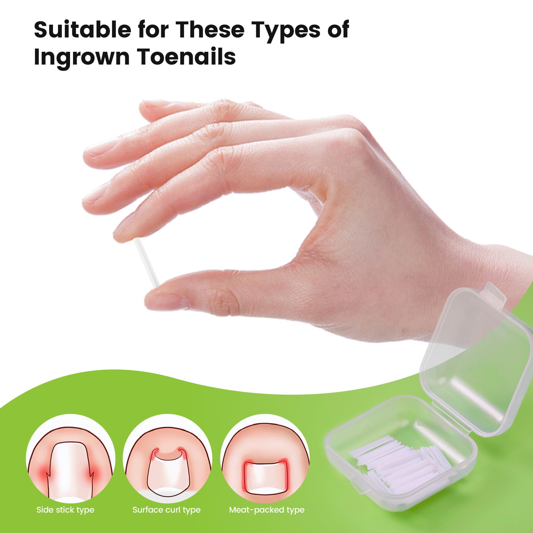 Bezox toenail correction kit inside storage case.