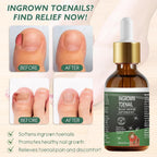 Side angle view of the herbal oil formulation showing premium ingredients for foot hygiene